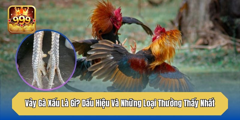 Vảy Gà Xấu Là Gì? Dấu Hiệu Và Những Loại Thường Thấy Nhất